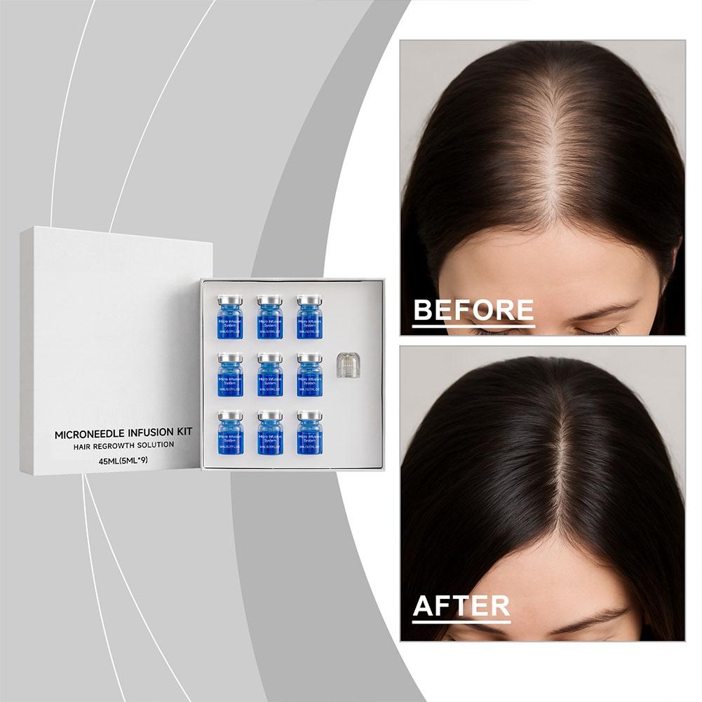 Derma Roller 0.25 - 0.25mm 헤어 에센셜 세럼 마이크로 니들