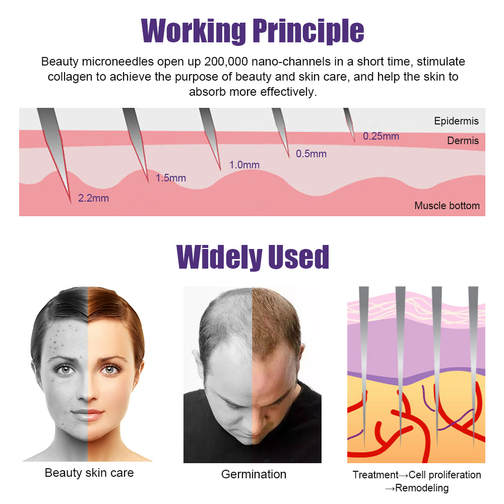 천연 남성 수염 성장 더마 롤러 DRS 540 마이크로 - Derma Roller 0.25 리뷰 및 가격